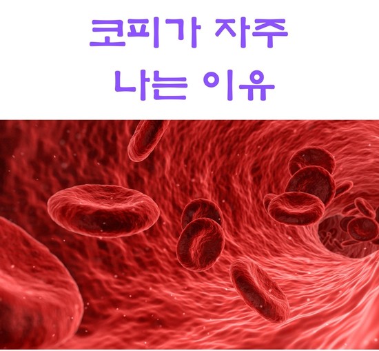  코피가 자주 나는 이유