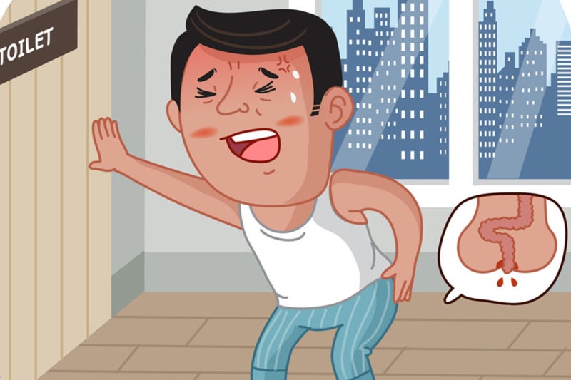 슬러지 치질, 치루가 생기는 원인을 알고 싶습니다. 7