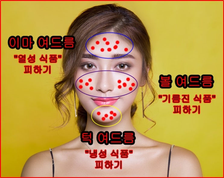  부위별 여드름의 진실, 이젠 안녕~!