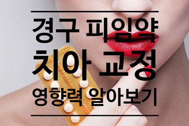 피임약이 교정 진행(속도)에 영향을 준다고? 치아 교정 중에 피임약 복용시 주의할 점, 미사교정치과 피임약이 교정 진행(속도)에 영향을 준다고? 치아 교정 중에 피임약 복용시 주의할 점, 미사교정치과