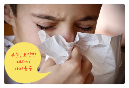 계절성 알레르기 비염, 가정에서 치료하세요. 코에픽