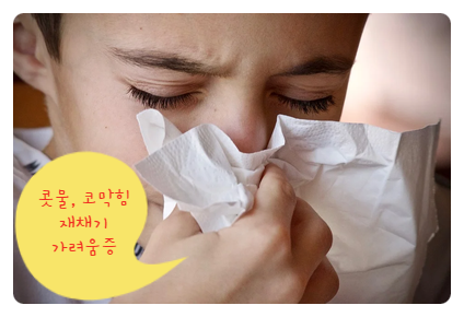  계절성 알레르기 비염, 가정에서 치료하세요. 코에픽