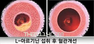  아르기닌 혈관확장 효능부작용: 협심증고혈압뇌졸증 발기부전임신중독증 다이어트권장량
