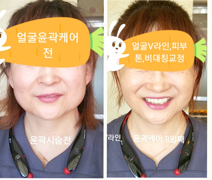  맑은 피부톤 갖고싶다면 디피엘관리(피부관리샵)제주도민 최대 50% 할인정보! (서귀포시 서귀동)