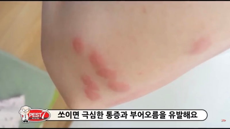 욕나오는 권연벌레 : 침개미:무는개미 : 네이버 블로그 욕나오는 권연벌레 : 침개미:무는개미 : 네이버 블로그