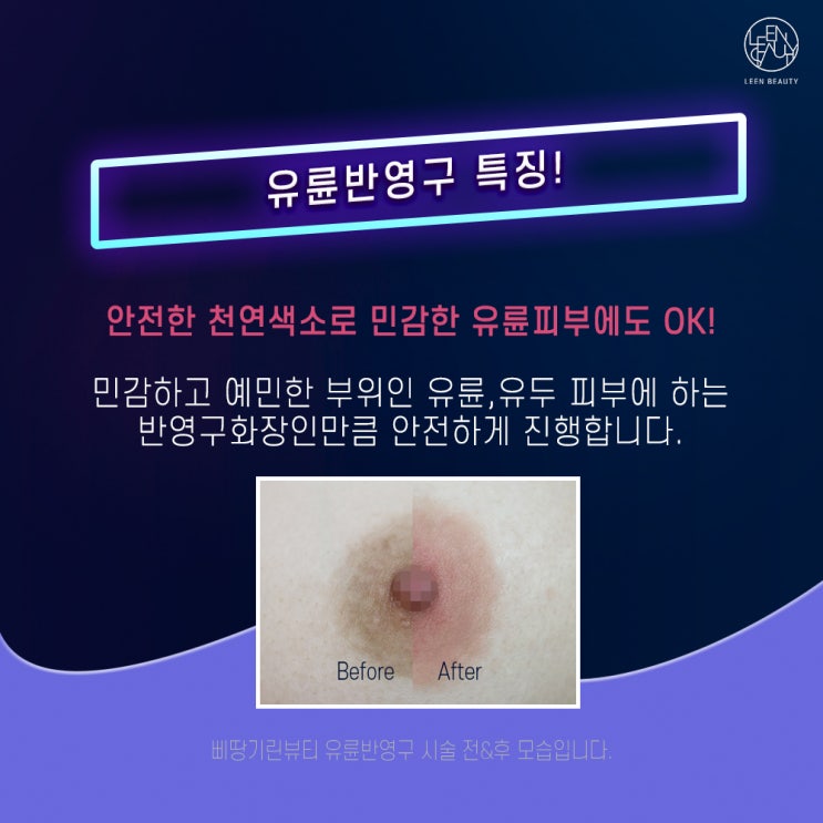  유두미백 확실하게 핑크핑크해지기!