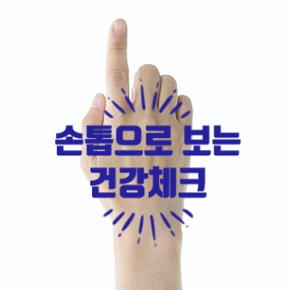  손톱 세로줄 갈라짐으로 알아보는 건강체크