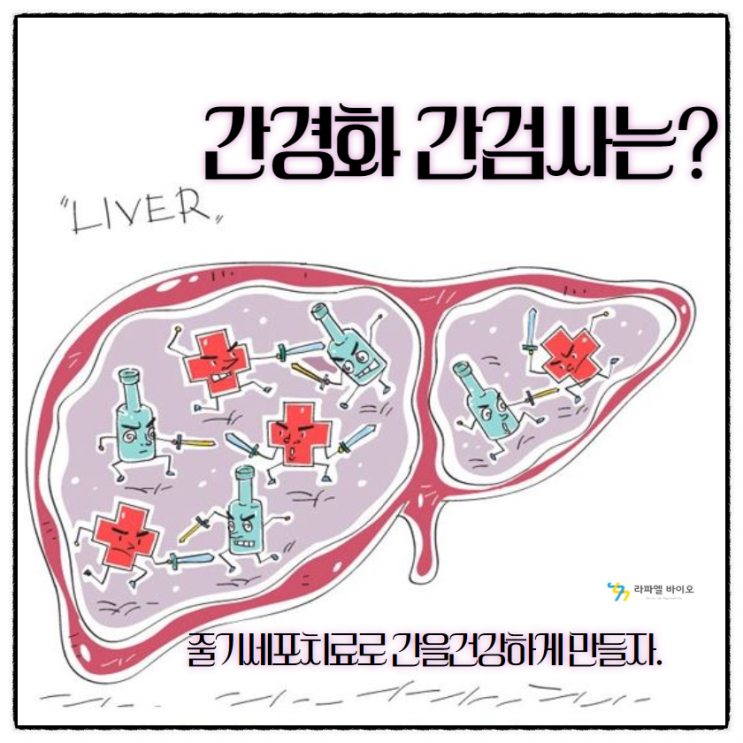  간경화 간검사 정상수치는? 줄기세포치료로 간이 어떻게 건강해질까?