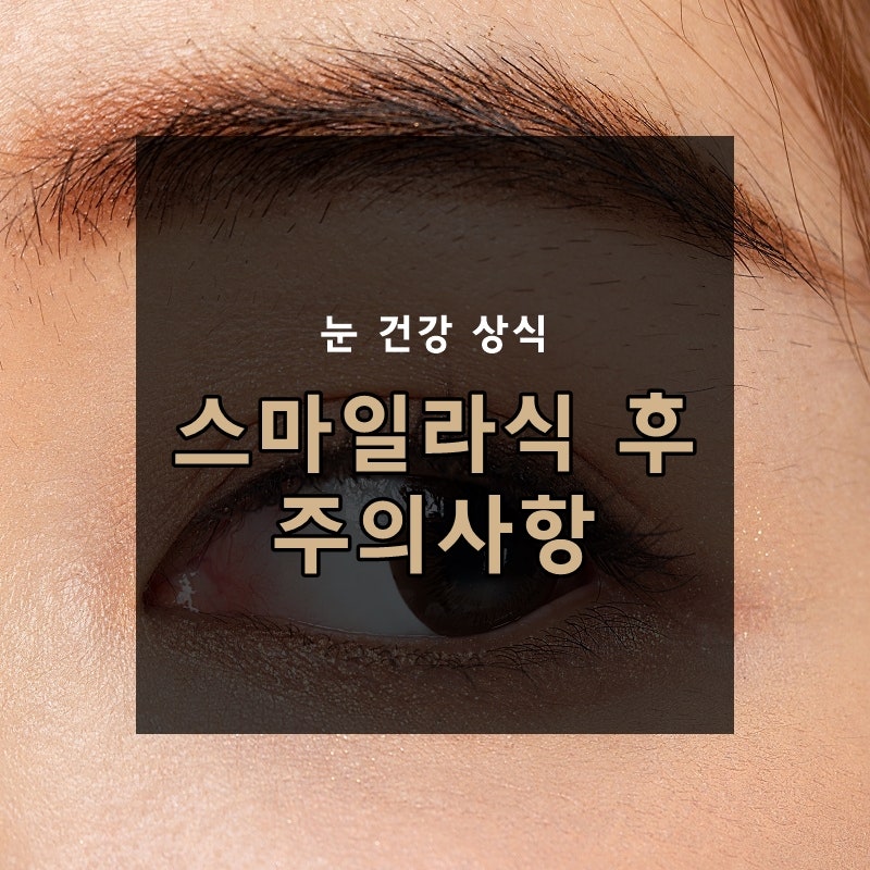 스마일라식 후 주의사항 무엇이 있을까요?