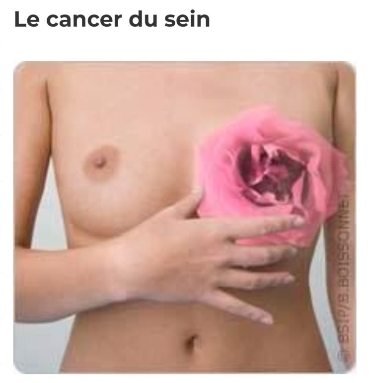  Le cancer du sein 유방암