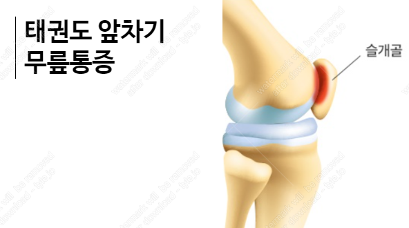 태권도 발차기 앞차기 할때 무릎통증 완화  및 예방법