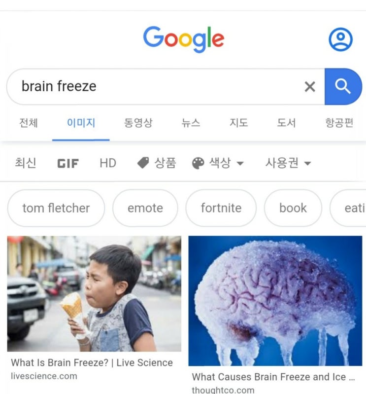  [궁금한것] brain freeze 란?