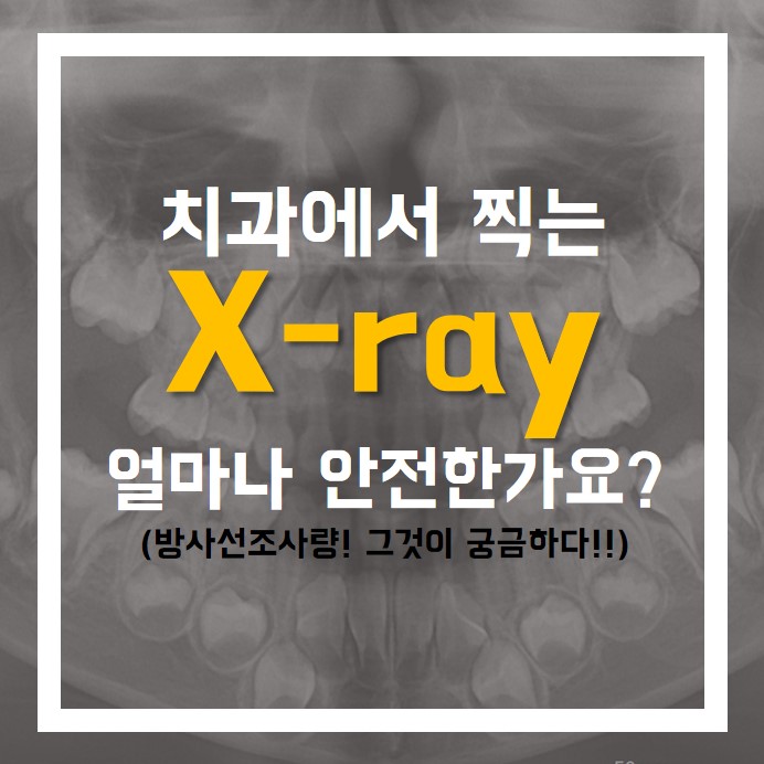치과에서 찍는 X-ray(방사선사진) 얼마나 안전한가 (방사선조사량, 파노라마, ct 등등)