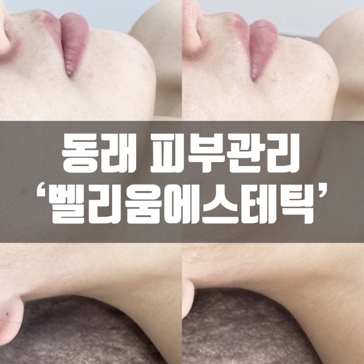  부산 동래 명륜동 피부관리 벨리움에스테틱에서 벤자민테라피 받고왔어용