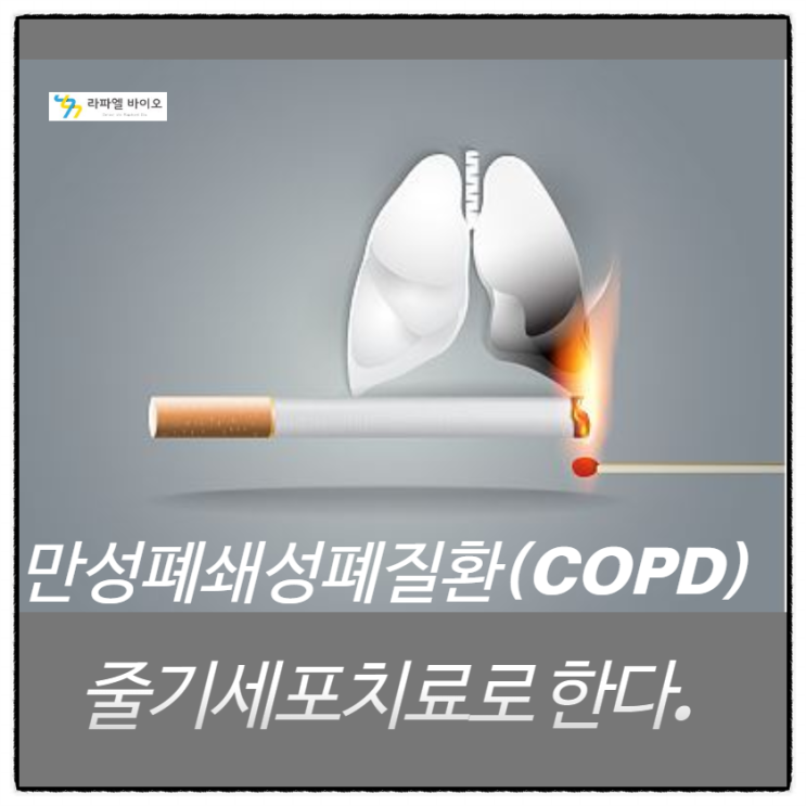 만성폐쇄성폐질환(COPD) 이란? 줄기세포치료가 어떤 효과가 있는지?