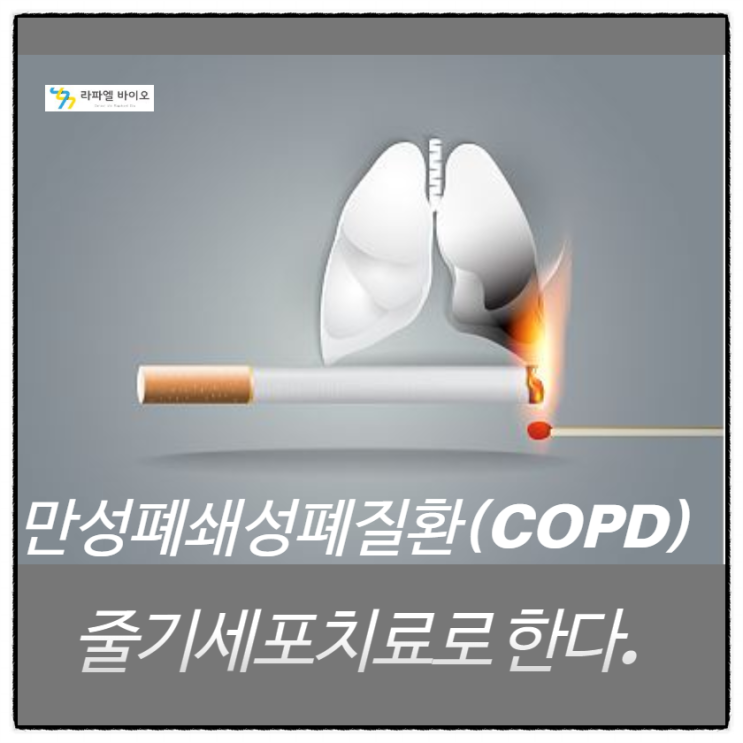  만성폐쇄성폐질환(COPD) 이란? 줄기세포치료가 어떤 효과가 있는지?