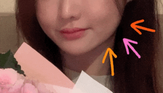  브잉라인 레인보우 스텝 솔루션 2회차 / 왕십리 피부과 윤곽주사