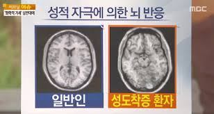  정신간호학 신체성도착증 문헌고찰: 음란증대소변애호증 소아성애자복장도착증 간호케이스