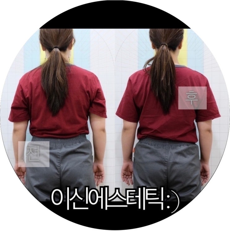  [부산 사하구 체형관리]하단 피부관리 체형관리 잘하는 이신에스테틱 : )