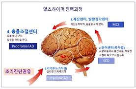 정신간호 치매알츠하이머진행과정 문헌고찰:치매진단기준 약물종류치료 간호케이스 정신간호 치매알츠하이머진행과정 문헌고찰:치매진단기준 약물종류치료 간호케이스