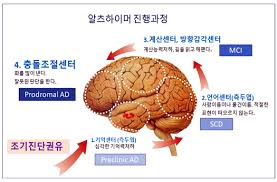 정신간호 치매알츠하이머진행과정 문헌고찰:치매진단기준 약물종류치료 간호케이스