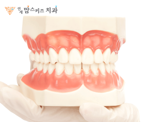3급 부정교합 환자의 치료와 시기 4