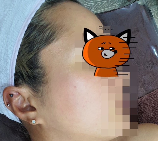 까치산역 에스테틱 라보떼 - 아쿠아필링 리뷰 5