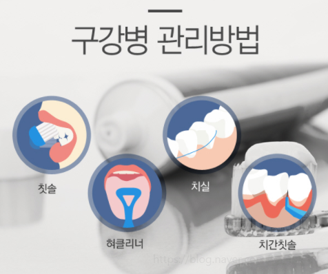  구강병예방프로젝트 /칫솔질과 치실질 제대로 하기