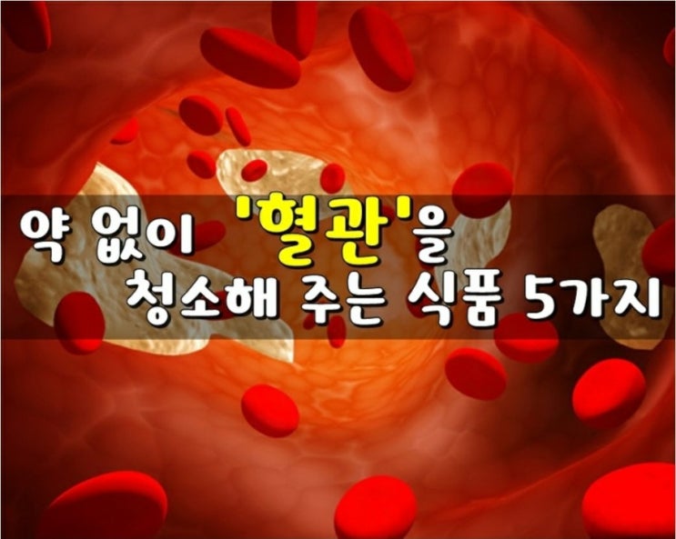 약 없이 혈관을 청소해 주는 식품 5가지 약 없이 혈관을 청소해 주는 식품 5가지