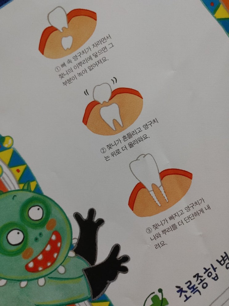  7살 치과에서 유치 뽑기 대작전!