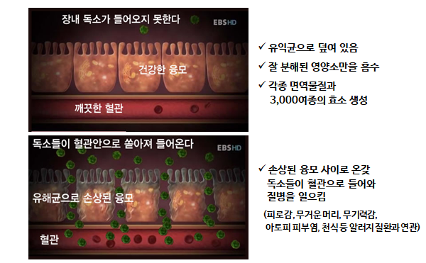  장 건강에 콜라겐이 필요한 이유와 콜라겐 선택법