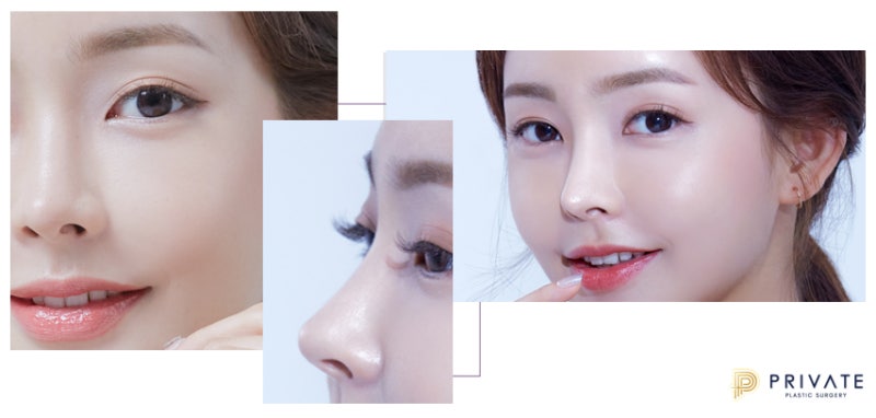 프라이빗성형외과 이준우원장님 사진 4