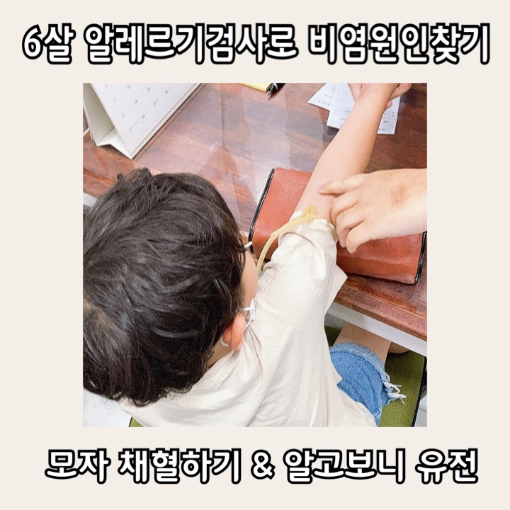  57개월 6살 육아일기 알레르기검사하다 비염이 심한 아이 알고보니 유전