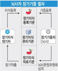 장기이식뜻정의 뇌사기증 인체조직기증절차: 장기이식역사 장기기증판정