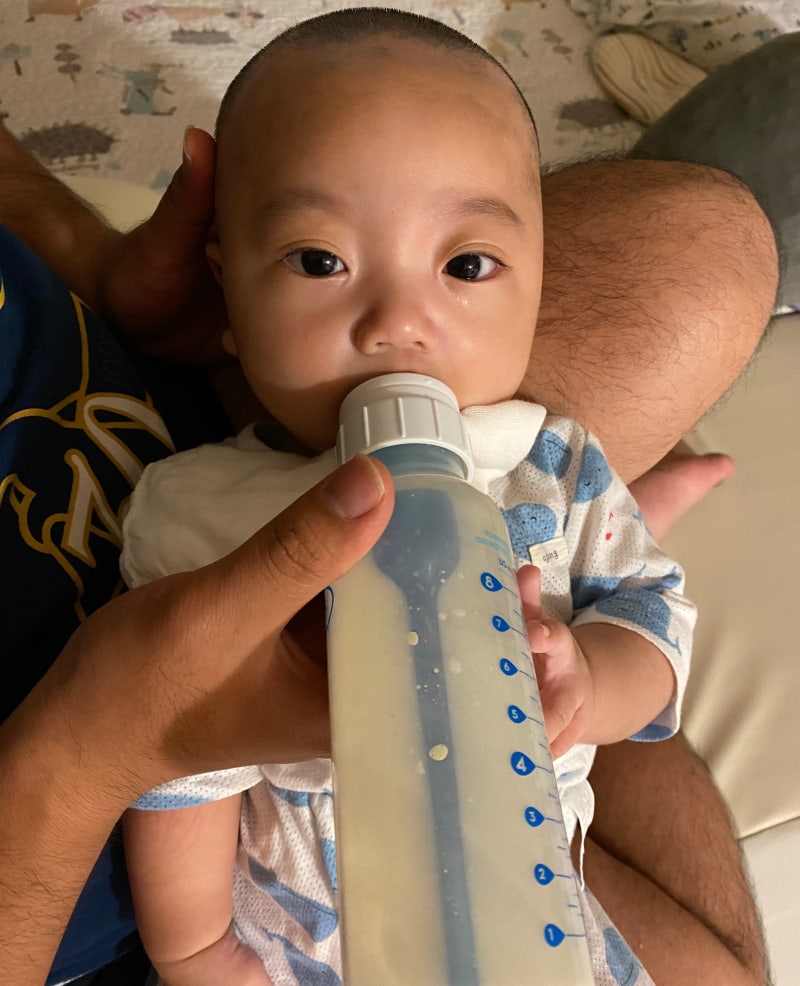 Latham 장치를 활용한 양측성 완전 구순구개열 환자의 치료: 증례보고, image size:800x986