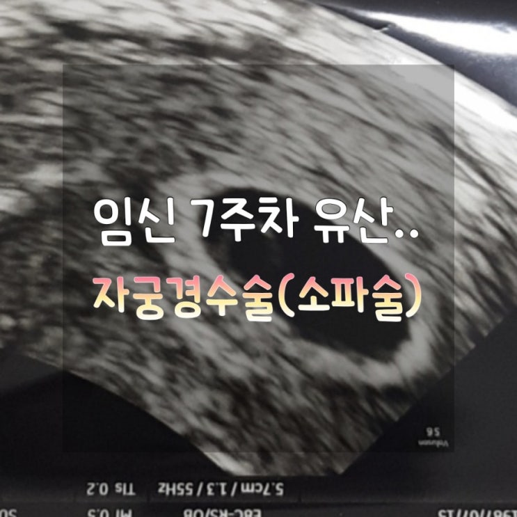  [둘째아이 임신 7주차 유산] 대학병원 자궁경수술