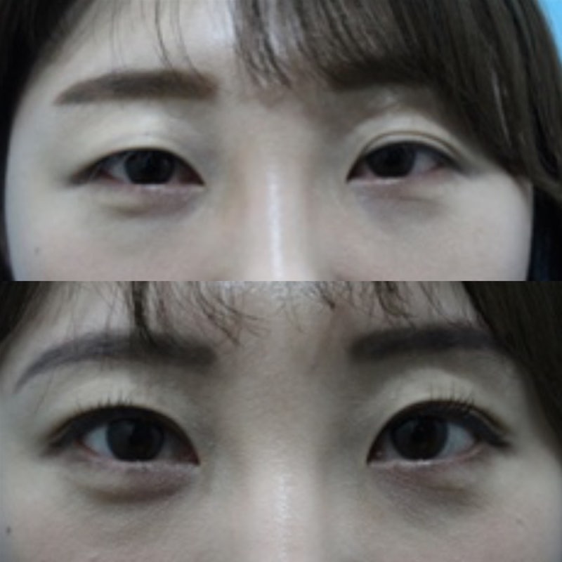 광주 동양미인 : 네이버 블로그 광주 동양미인 : 네이버 블로그