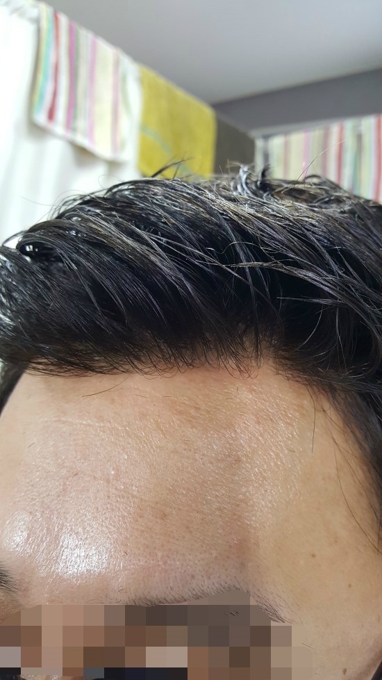  하이모 가격 자연미 대안 가발업체를 찾기