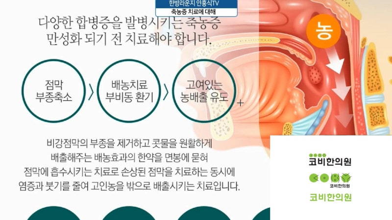 축농증한방치료 이곳에서 시작해보자