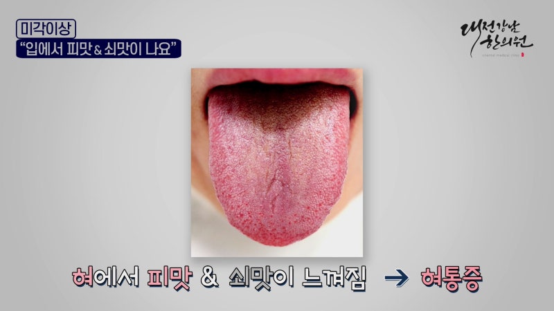 입에서 피맛 쇠맛이 나요! 미각이상 증상과 원인은? : 네이버 블로그
