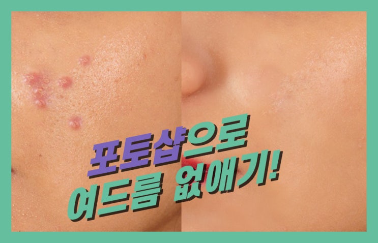  포토샵 힐링 브러쉬 사용법! 간단해요