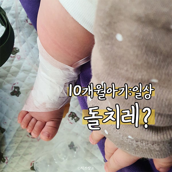 별 일 없이 지나갈 줄 알았는데 62개월 발열발달 후기를 올려봅니다.