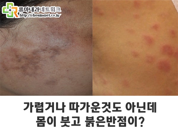 반점제거 연고 나만의 인생앰플 아마존크림 메리얼 앰플 13