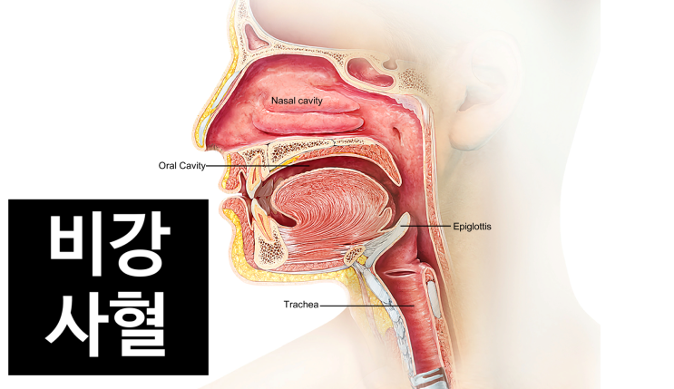 코막힘에는 비강사혈 - 비염, 축농증, 후비루에 좋아요 [수원 영통 새움한의원]