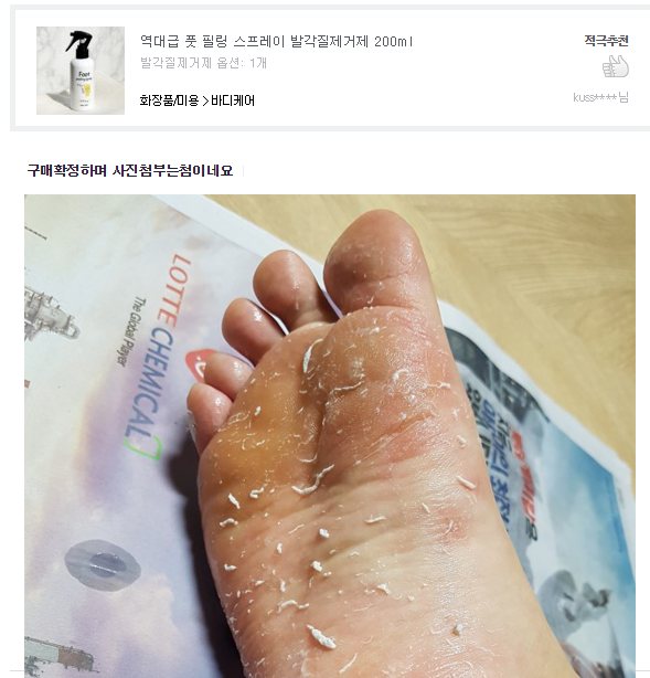 역대급 커먼스 발각질 제거제 역대급 커먼스 발각질 제거제