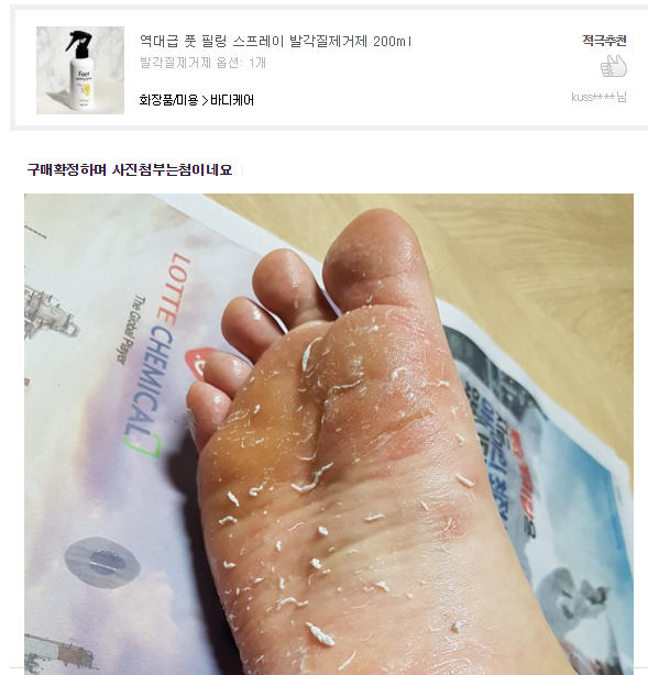 역대급 커먼스 발각질 제거제