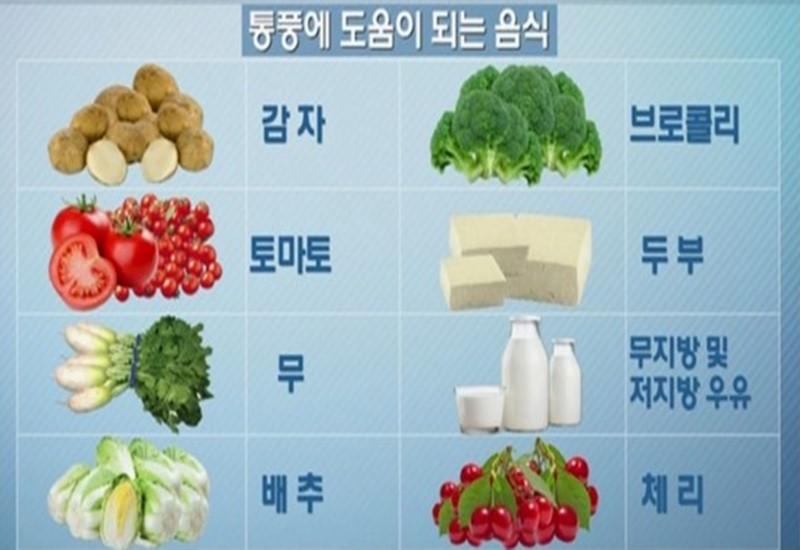 통풍에 좋지 않은 음식, 통풍의 원인, 관리방법