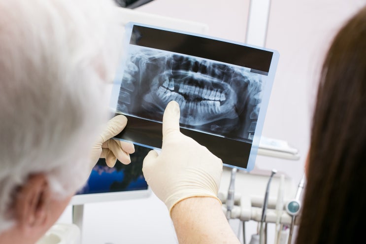 치과용 방사선, 안전성은 어떻게 될까요?