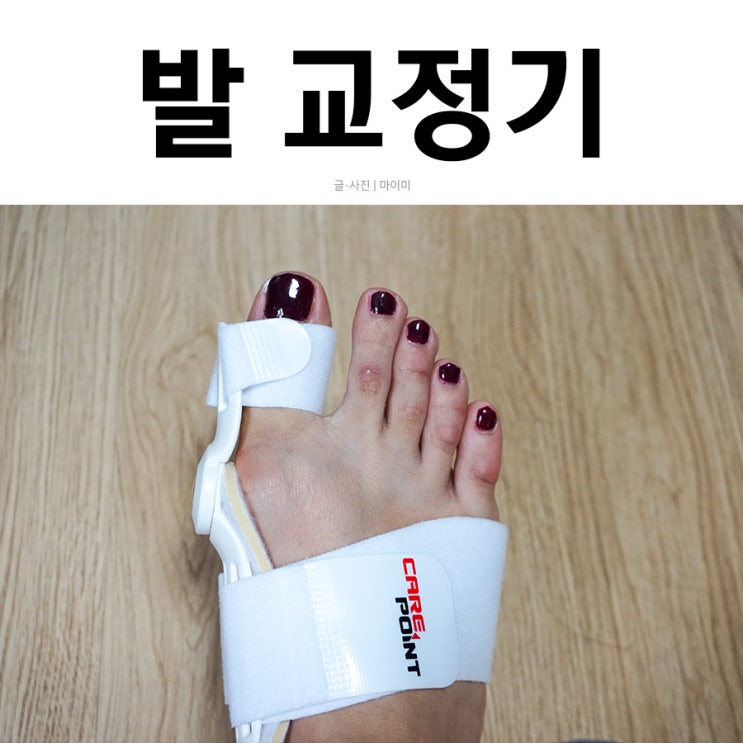  무지외반증교정기 쉽게 교정할 수 있는 케어포인트의 엄지픽스