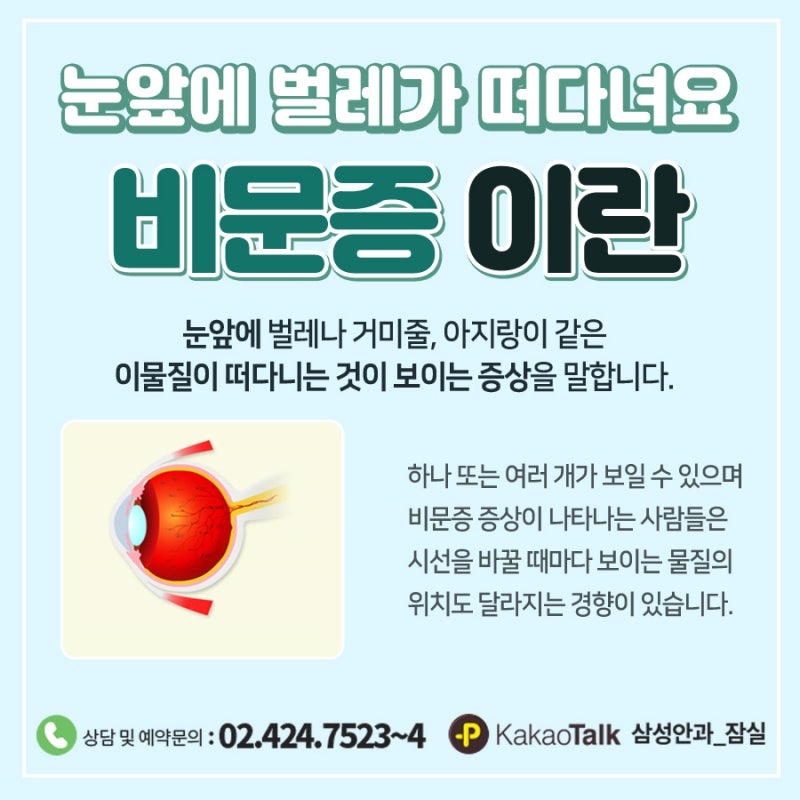 비문증수술 필요한 경우 눈에아지랑이 보이는 이유
